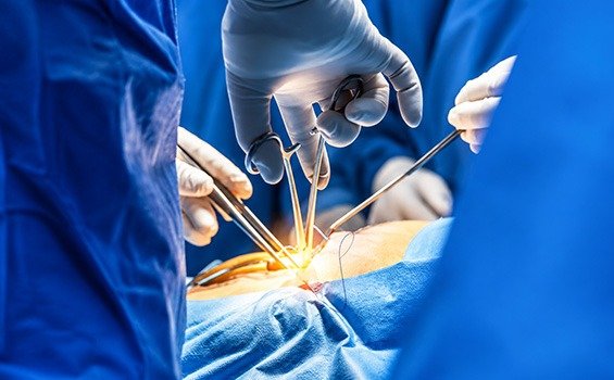 How to Prepare for Liver Cancer Surgery?