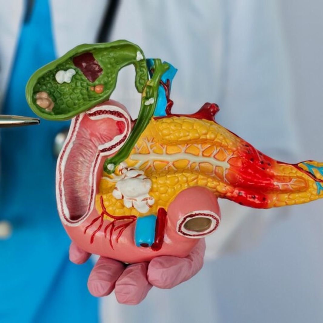 GI Cancer Surgery Illustration