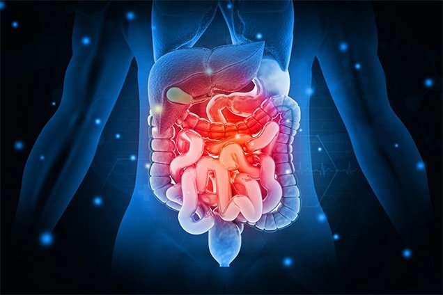 Symptoms of Retroperitoneal Sarcoma