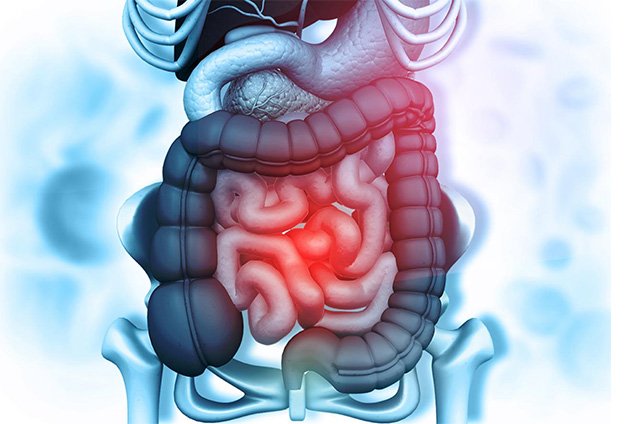 Types of Retroperitoneal Sarcoma