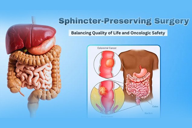 Sphincter-Preserving Surgery