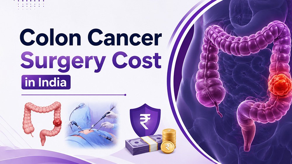 colon-cancer-surgery-cost-in-india
